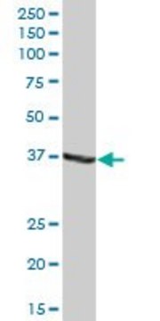 Anti-ADH1C antibody produced in mouse