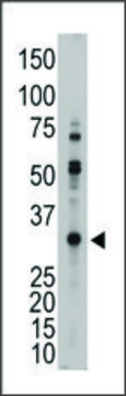 Anti-MMP26 (N-term) antibody produced in