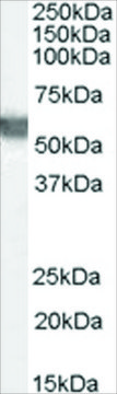 Anti-G6PD (AA 308-320) antibody produced