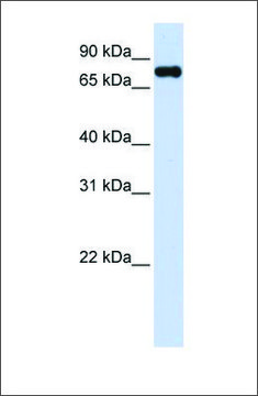 Anti-ZFYVE1 antibody produced in rabbit