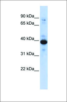 Anti-RNF34 antibody produced in rabbit