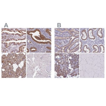 Anti-TMED10 antibody produced in rabbit