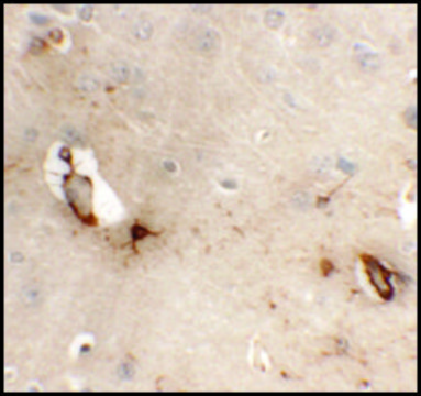 Anti-TMEM204 antibody produced in rabbit
