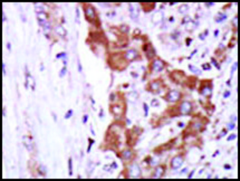 Anti-CAMK2? (C-term) antibody produced in