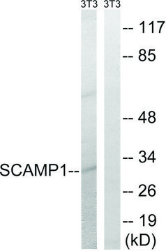 Anti-SCAMP1 antibody produced in rabbit