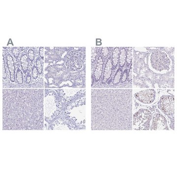 Anti-LUZP4 antibody produced in rabbit