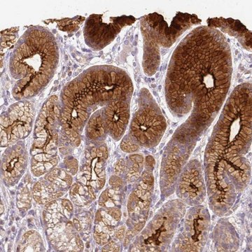 Anti-FER1L6 antibody produced in rabbit