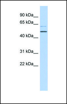 Anti-TBC1D10C, (N-terminal) antibody produced in