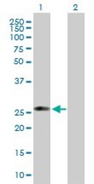Anti-C1QTNF5 antibody produced in mouse