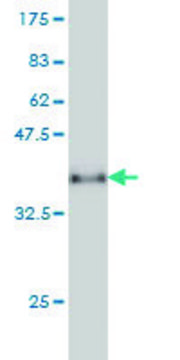 Monoclonal Anti-CXCL5 antibody produced in