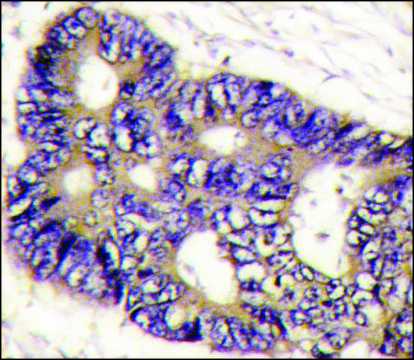 Anti-FUCA2 (C-term) antibody produced in