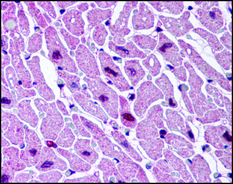 Anti-CYSLT2 (AB2) antibody produced in