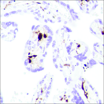 Anti-Coagulation Factor XIII A, Rabbit