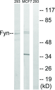 Anti-FYN antibody produced in rabbit