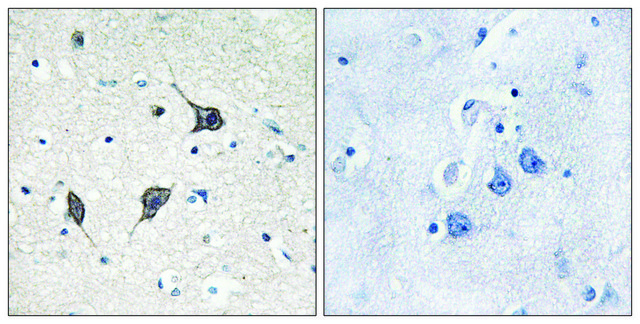 Anti-GPR20 antibody produced in rabbit