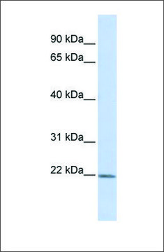 Anti-ZFAND5 antibody produced in rabbit