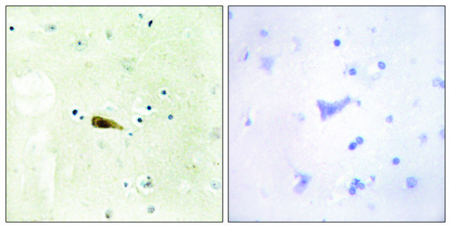 Anti-MYST1 antibody produced in rabbit