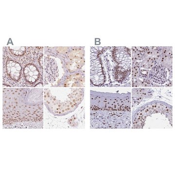 Anti-PPP1R10 antibody produced in rabbit