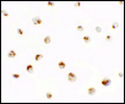 Anti-SDHD antibody produced in rabbit