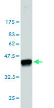 Monoclonal Anti-FHIT antibody produced in