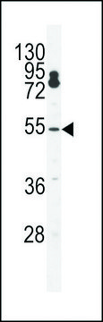 ANTI-CPSF7(C-TERMINAL) antibody produced in rabbit