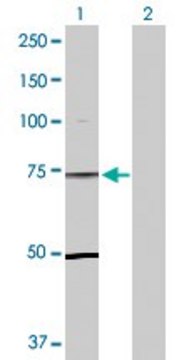 Anti-TLE1 antibody produced in rabbit