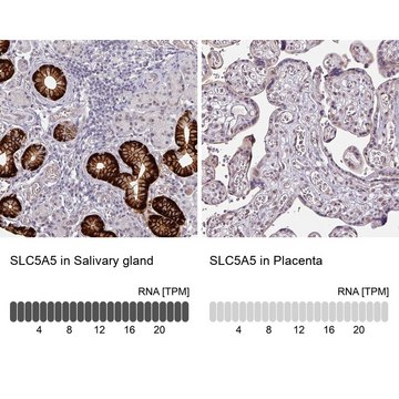Anti-SLC5A5 antibody produced in rabbit