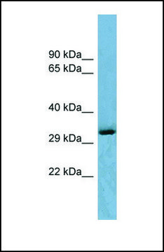 Anti-OTUD6B antibody produced in rabbit