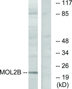 Anti-MOBKL2B antibody produced in rabbit