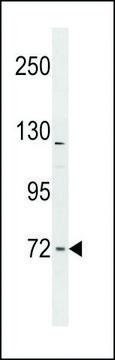 ANTI-FNBP1L (CENTER) antibody produced in