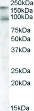 Anti-CDCP1 (Isoform 1), C-Terminal antibody