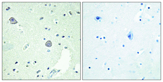 Anti-DRD1 antibody produced in rabbit