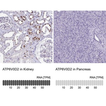 Anti-ATP6V0D2 antibody produced in rabbit