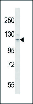ANTI-MOUSE FLT3 (N-TERM) antibody produced