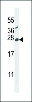 ANTI-TNFAIP8L2 (N-TERM) antibody produced in