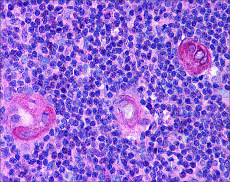 Anti-BCL11B antibody produced in rabbit
