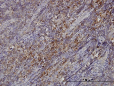 Monoclonal Anti-RASGRP4 antibody produced in
