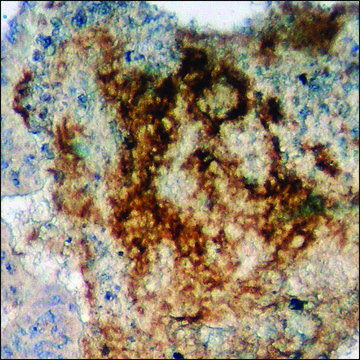 Anti-phospho-HER3 (pTyr¹²²²) antibody produced in