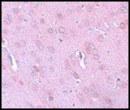 Anti-TRESK antibody produced in rabbit