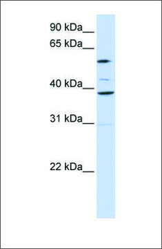 Anti-SLC25A16 antibody produced in rabbit