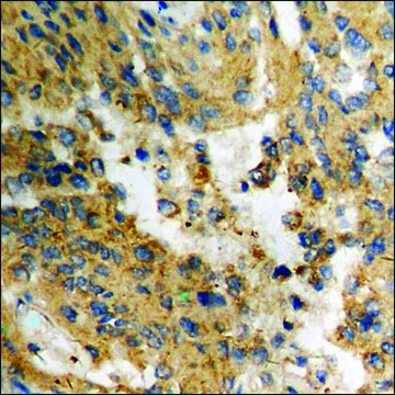 Anti-phospho-AKT1 (pThr³??) antibody produced in