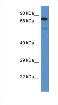 Anti-GALNT3 antibody produced in rabbit