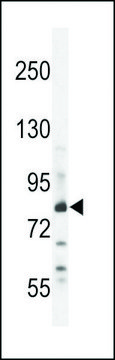 ANTI-ZN180 (N-TERMINAL) antibody produced in