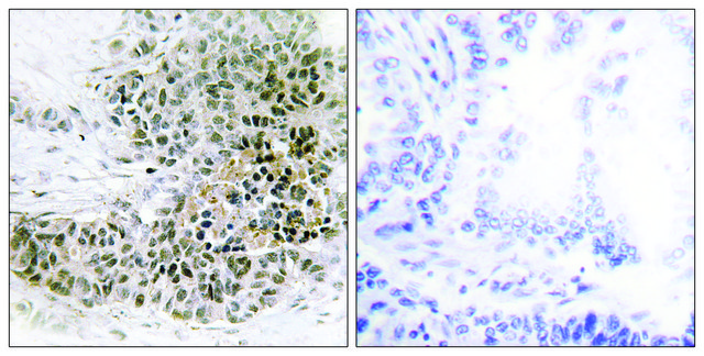 Anti-TRPS1 antibody produced in rabbit