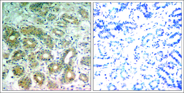 Anti-PTPN11 (Ab-542) antibody produced in