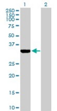 Anti-ECH1 antibody produced in rabbit