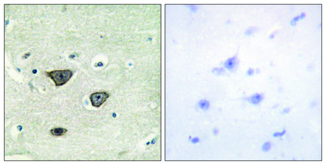 Anti-CDH8 antibody produced in rabbit