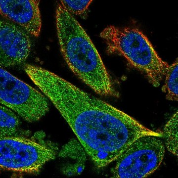 Anti-TCTEX1D2 antibody produced in rabbit