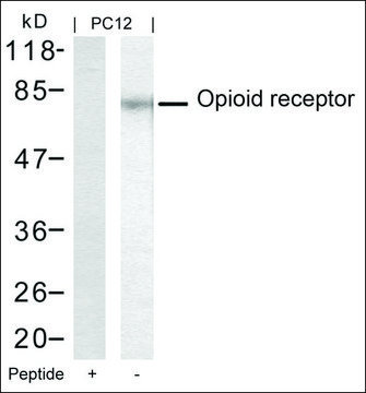 Anti-OPRM1 (Ab-375) antibody produced in