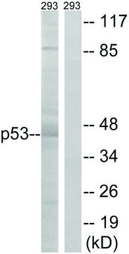 Anti-p53 antibody produced in rabbit